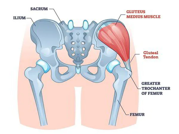 Gluteal Tendon Repair Dr. Pradyumna