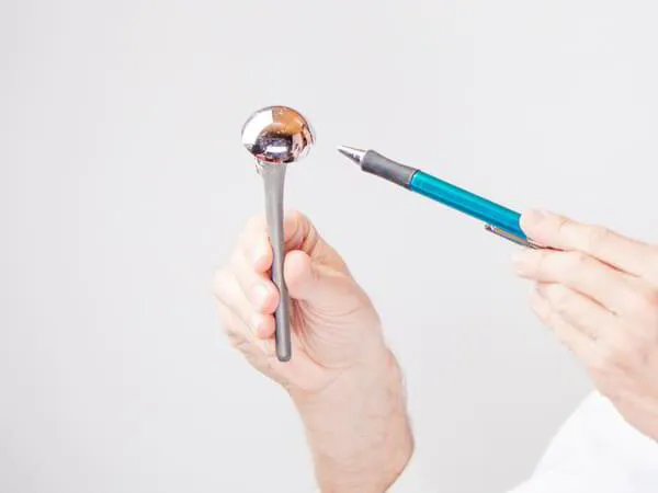 Revision Shoulder Replacement Surgeon Dr. Pradyumna