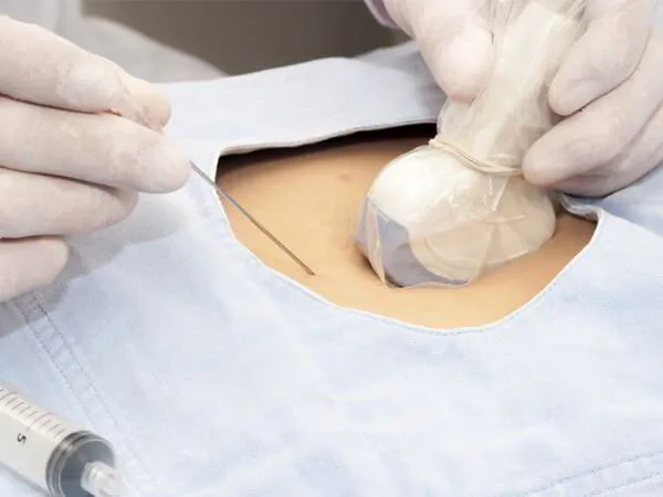 Ultrasound-guided Hip Injection Dr. Pradyumna