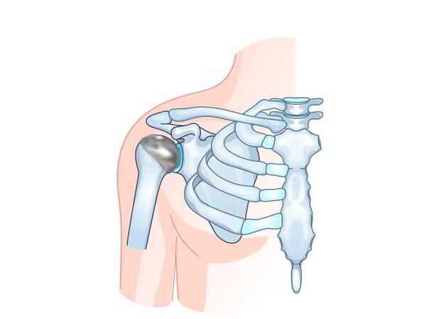 Partial Shoulder Replacement Dr. Pradyumna