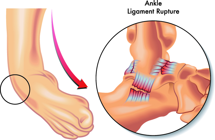 SLAP Repair Surgeon Dr. Pradyumna